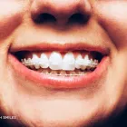 Business 3 image BAGENALSTOWN DENTAL CARLOW Dentists in Muine Bheag CW