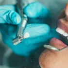 Business 10 image CROWN DENTAL DUBLIN Dentists in Dublin D