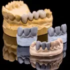 Business 7 image CROWN DENTAL DUBLIN Dentists in Dublin D