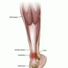 Business 7 image ENERGISE, PHYSICAL THERAPY AND SPORTS INJURY CLINIC Sports Injury Clinics in Wicklow WW