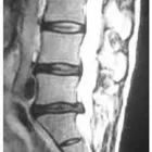 Business 5 image HAVEN PAIN RELIEF CENTRE Physiotherapists in Douglas CO