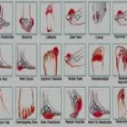 Business 6 image JAYNE ORR FOOT CLINIC Reflexologists in Bundoran DL