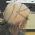 Business 4 image JK HAIR REPLACEMENT Wigs & Hairpieces in Dublin IE


