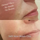 Business 4 image SIXTH SENSE BEAUTY CLINIC Health & Medicine in Limerick IE


