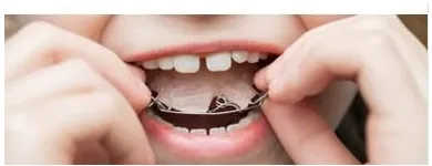 Business 2 image ANN MARIE OWENS BDS NUI, MFDS RCS, MSC ORTH, MORTH RCS Orthodontists in Cork CO