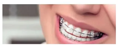Business 4 image ANN MARIE OWENS BDS NUI, MFDS RCS, MSC ORTH, MORTH RCS Orthodontists in Cork CO