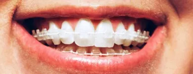 Business 3 image BAGENALSTOWN DENTAL CARLOW Dentists in Muine Bheag CW