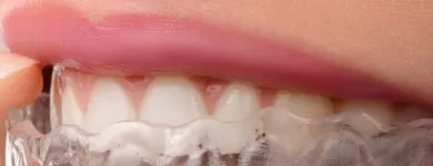 Business 2 image BAGENALSTOWN DENTAL CARLOW Dentists in Muine Bheag CW