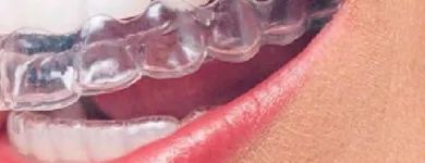 Business 5 image ORTHODENTAL ABBEYLEIX Orthodontists in Abbeyleix LS