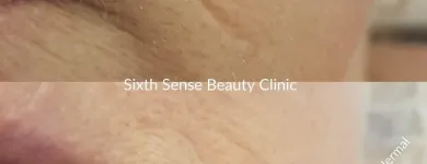 Business 1 image SIXTH SENSE BEAUTY CLINIC Health & Medicine in Limerick IE


